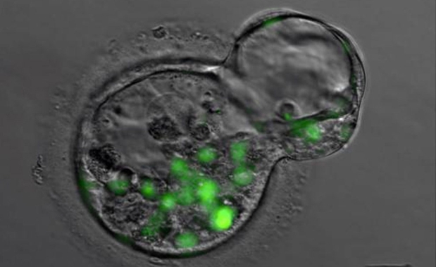 Medio ambiente, herencia y azar se combinan para producir cáncer