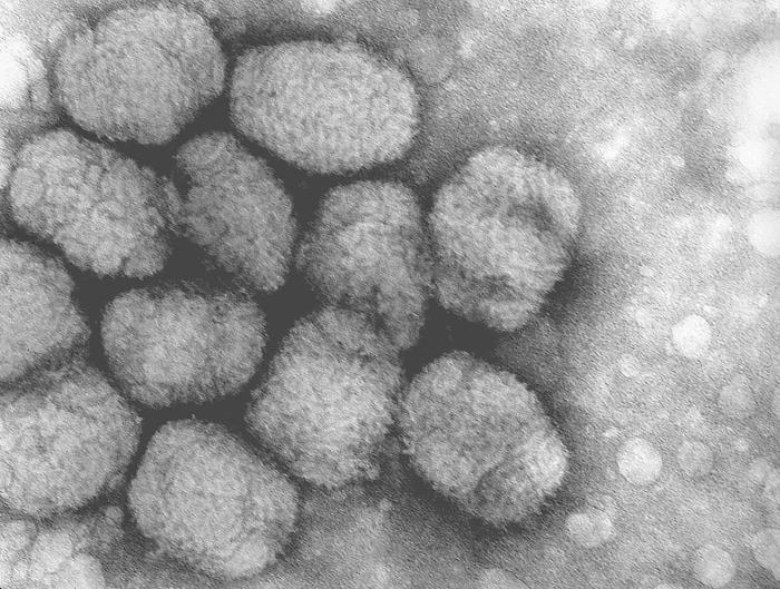 Virus de la viruela humana. Fuente: Wikimedia Commons.