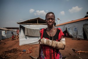 Una refugiada en el campo de Cacanda muestra la herida traumática causada durante el conflicto en la República Democrática del Congo (RDC). MSF proporciona servicios de salud mental a los refugiados que lo necesiten, muchos de ellos testigos o víctimas directas de la violencia. ©Bruno Fonseca