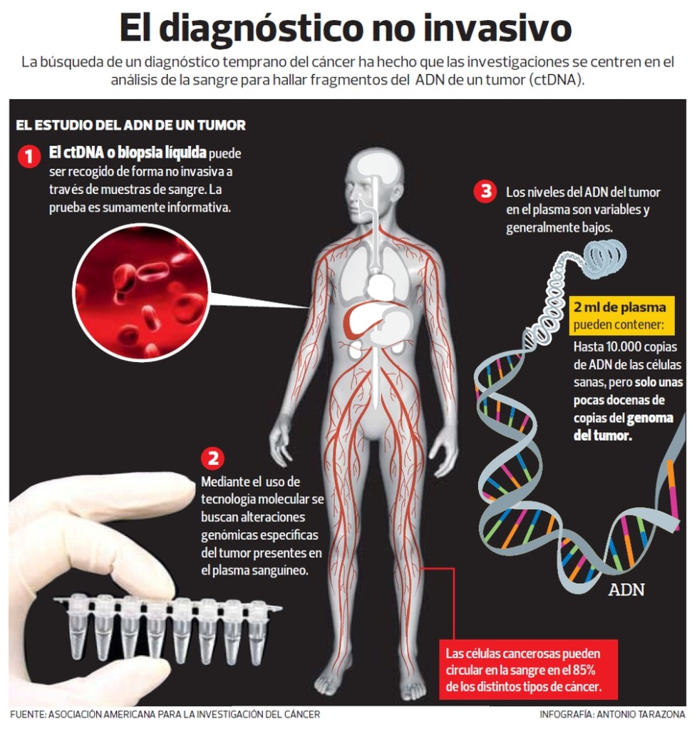 Infografía Nuevo diagnóstico del cáncer