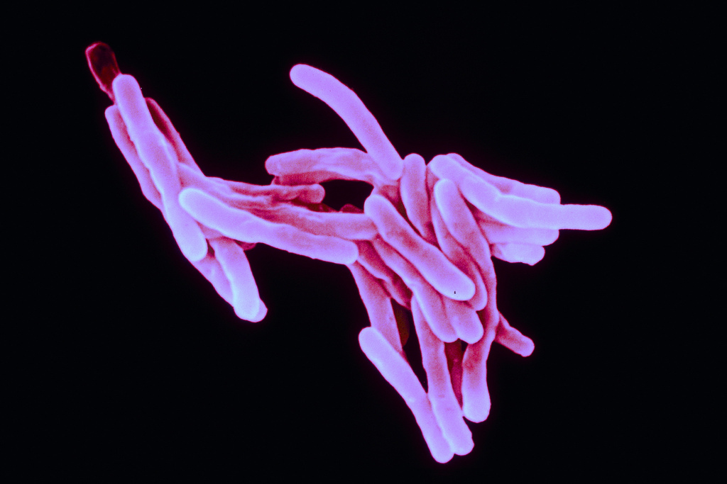 Mycobacterium tuberculosis. Fuente: CropWatch.