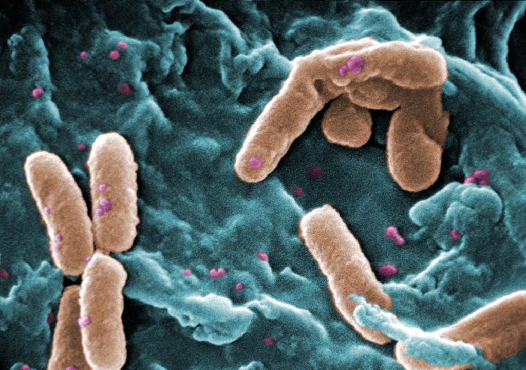 Micrografía electrónica de barrido de la bacteria Pseudomonas aeruginosa, asociada con frecuencia a las infecciones pulmonares graves que complican la fibrosis quística. Fuente: Wikimedia Commons.