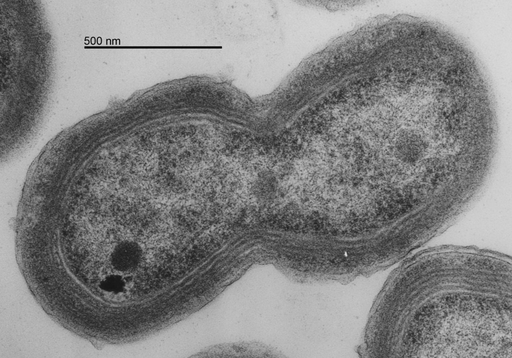 Fotografía de un Prochlorococcus. Fuente: MIT