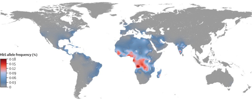 Prevalencia del gen defectuoso que provoca la anemia de células falciformes. Fuente: The Lancet.